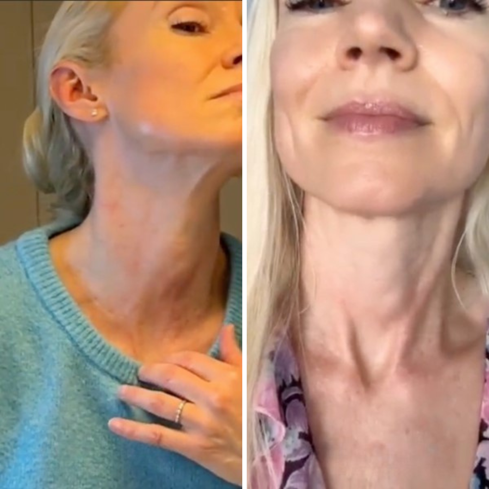 Lachs-DNA Bio-Kollagen Lifting-Creme für Gesicht, Hals & Doppelkinn